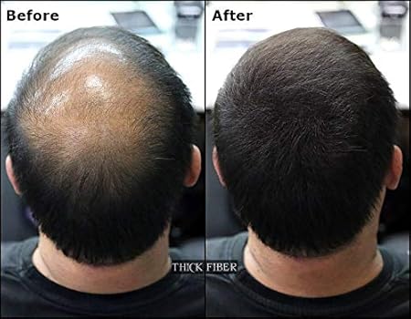 THICK FIBER - Hair Fibers for Thinning Hair